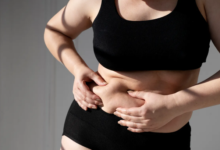 Is a Tummy Tuck in Dubai Your Key to a Confident Silhouette?